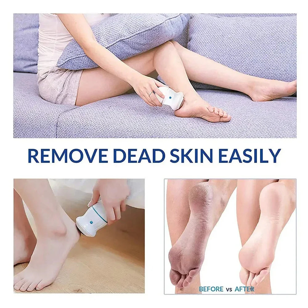 Electric Foot Scrubber – Rechargeable Callus Remover for Salon-Smooth Feet at Home